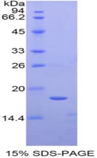 Human TAF13 Protein (Recombinant His-T7)