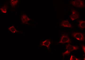 FPR1 / FPR Antibody