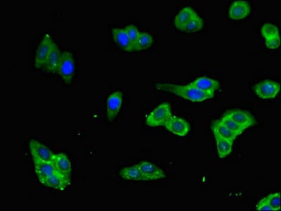 FAM151B Antibody