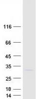 Human MOB1B / MOBKL1A Protein (Recombinant Myc-DDK (Flag))
