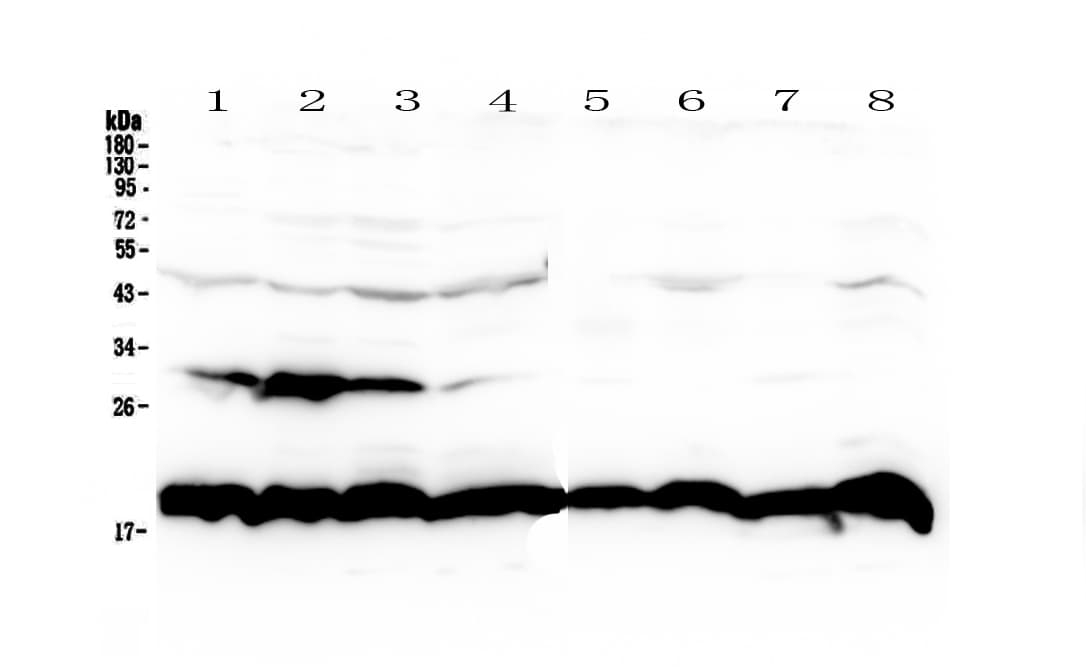 Polyclonal Rabbit anti-Human PPIB / Cyclophilin B Antibody (IHC, WB)
