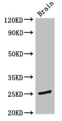 TMEM186 Antibody