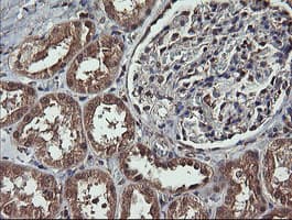 MAP2K1 / MKK1 / MEK1 Antibody (clone OTI2F12)