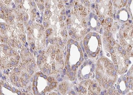 ATP5B / ATP Synthase Beta Antibody