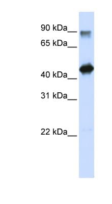 Polyclonal Rabbit anti-Human HMG20A Antibody (N-Terminus, WB)