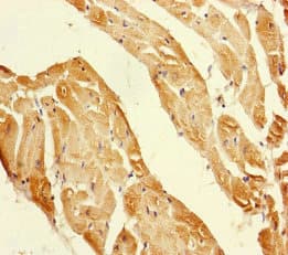 PPIF / Cyclophilin F Antibody