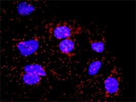IHC-plus™ BUB1B / BubR1 Antibody (clone 2G5)