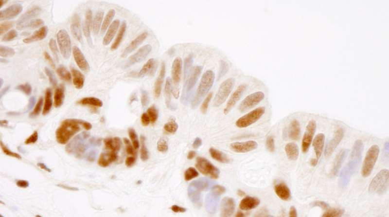 Polyclonal Rabbit anti-Human GTF2I / TFII I Antibody (aa985-998, IHC, IF)