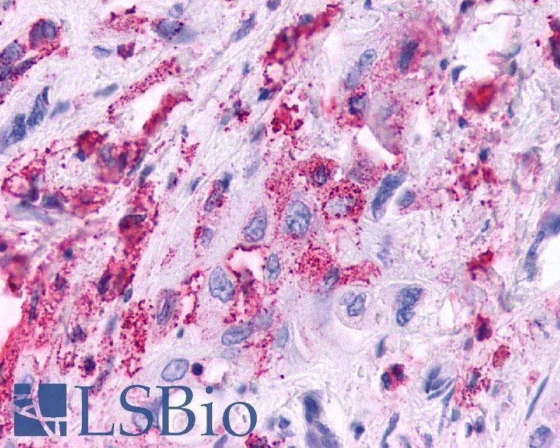 PathPlus™ KISS1R / GPR54 Antibody (N-Terminus)