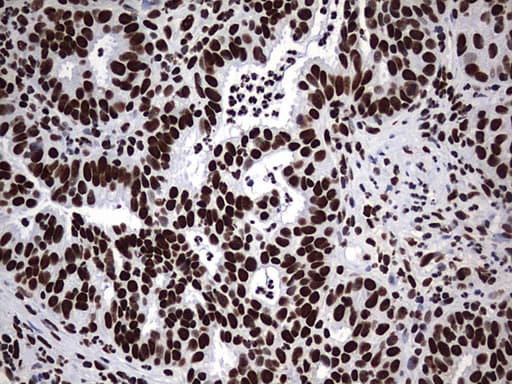 HNRPM / HNRNPM Antibody (aa1-261, clone OTI1E12)