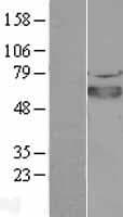 SOX4 Protein (Over-Expression Lysate Myc-DDK (Flag))