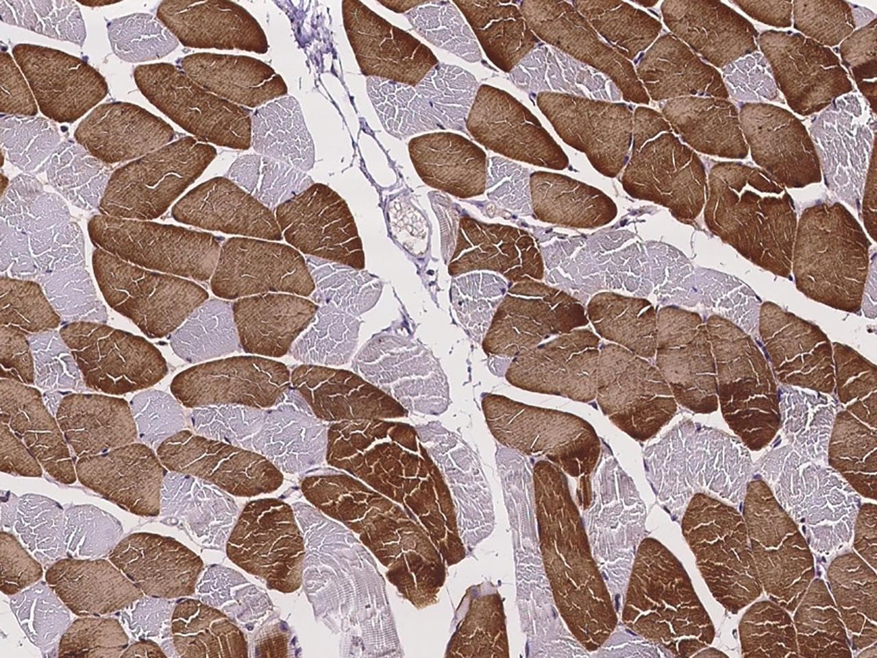 TNNC1 / Cardiac Troponin C Antibody