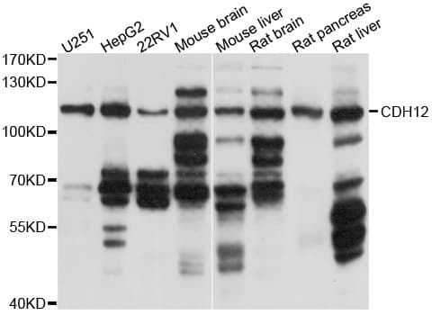 CDH12 / Cadherin 12 Antibody