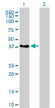 IHC-plus™ HNRNP-E2 / PCBP2 Antibody (clone 5F12)