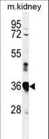Polyclonal Rabbit anti-Human MARCH5 Antibody (aa4-32, IHC, WB)