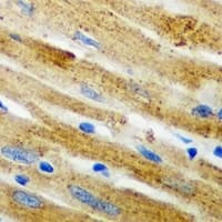 CARS1 / CARS Antibody