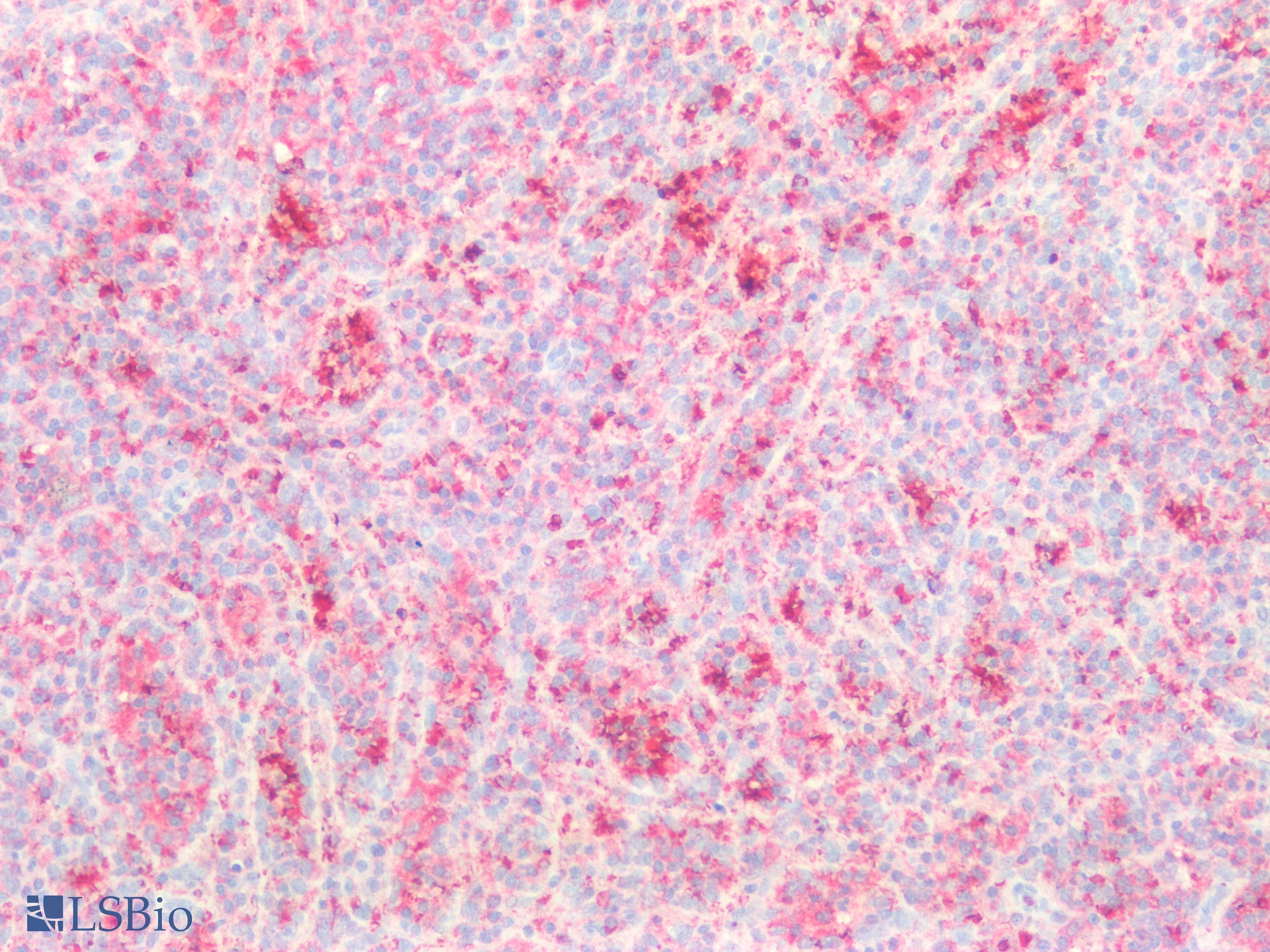 PathPlus™ SLC2A1 / GLUT-1 Antibody (Concentrated)