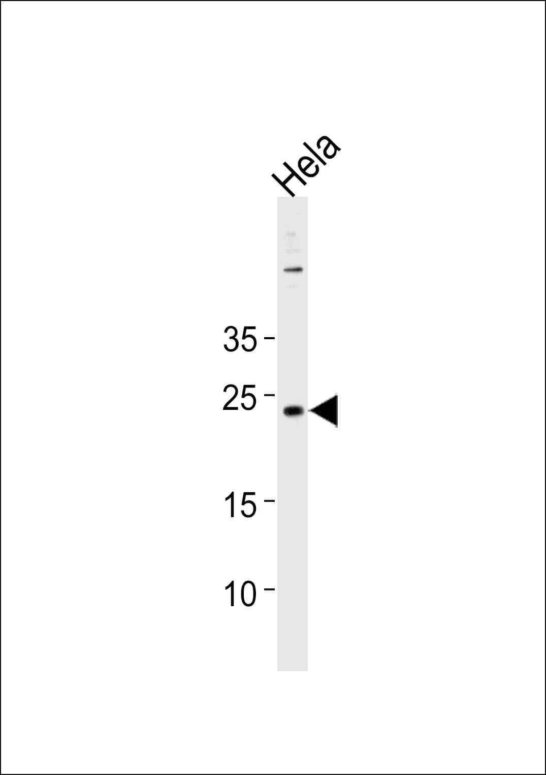 Polyclonal Rabbit anti-Human CNO Antibody (aa114-143, WB)