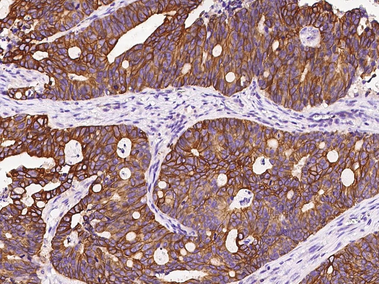 KRT12 / CK12 / Cytokeratin 12 Antibody