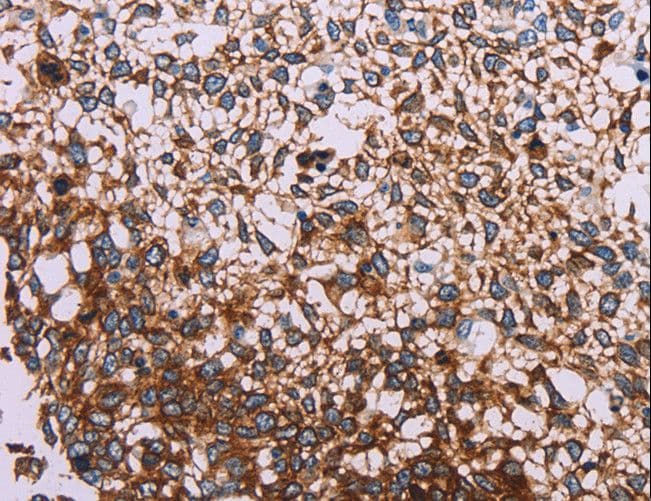 KRT14 / CK14 / Cytokeratin 14 Antibody