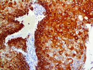 KRT17 / CK17 / Cytokeratin 17 Antibody