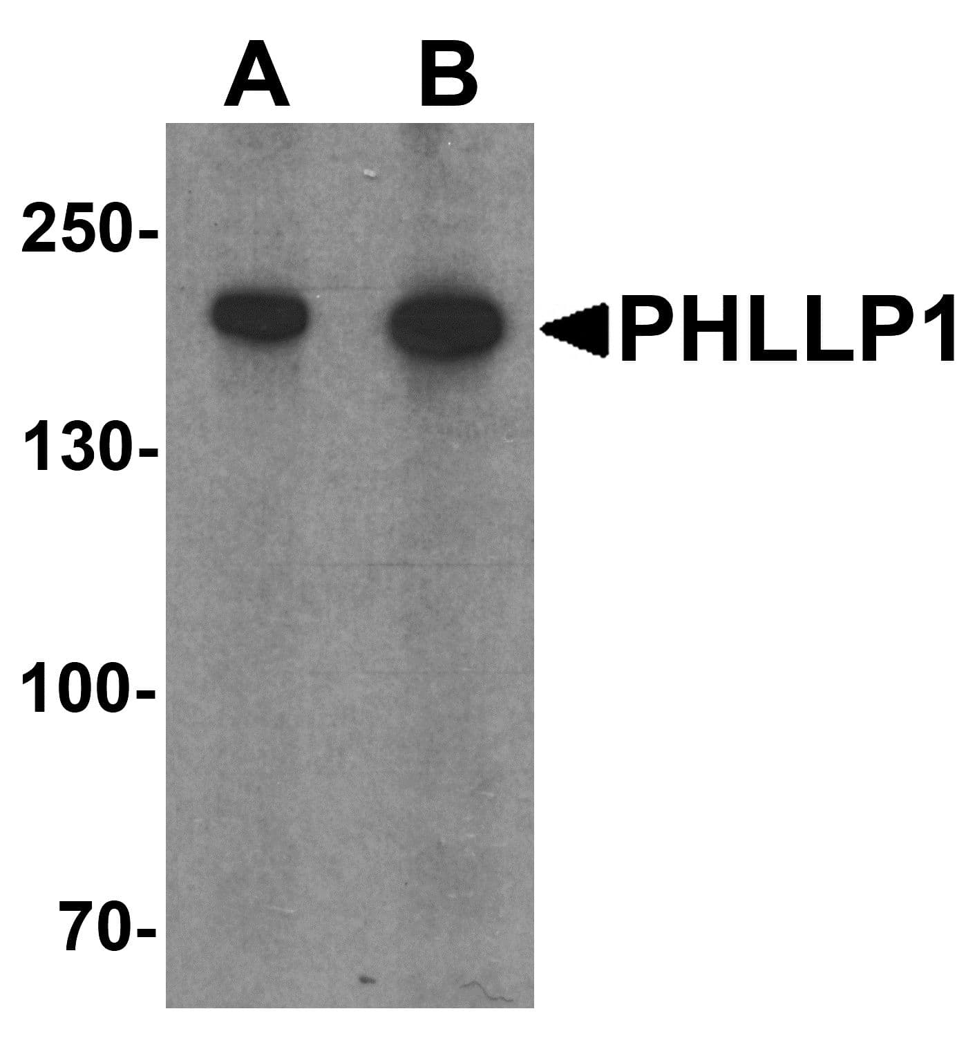 IHC-plus™ Polyclonal Rabbit anti-Human SCOP / PHLPP Antibody (IHC, IF, WB)