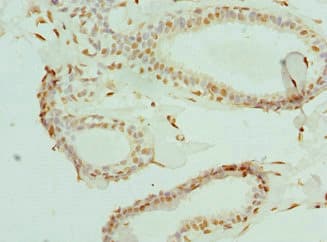 Polyclonal Rabbit anti-Human ELF1 Antibody (IHC, WB)