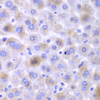 Polyclonal Rabbit anti-Human EPHX1 / Epoxide Hydrolase 1 Antibody (IHC, IF, WB)