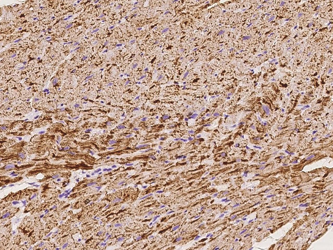 NDUFB7 / B18 Antibody