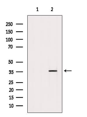 Polyclonal Rabbit anti-Human EXOSC8 Antibody (WB)