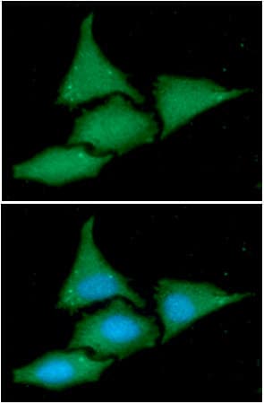 BAG2 Antibody (clone AT29E9)