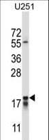 Polyclonal Rabbit anti-Human CTAG2 Antibody (aa122-149, IHC, WB)