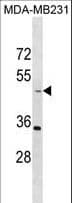 TAPBP / Tapasin Antibody (aa42-70)