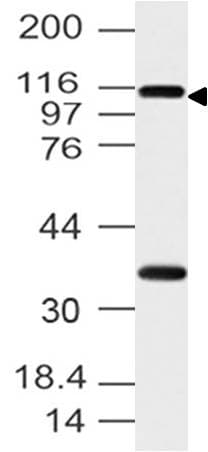 Polyclonal Rabbit anti-Human FMNL3 Antibody (aa1-368, WB)