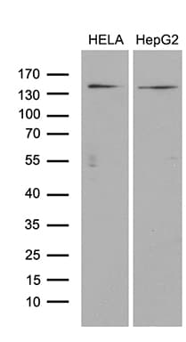 Monoclonal Mouse anti-Human ARHGEF18 Antibody (clone OTI6D10, Carrier-free, aa118-215, IHC, WB)