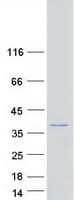 Human IBA57 / C1orf69 Protein (Recombinant Myc-DDK (Flag))
