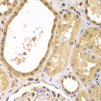 Polyclonal Rabbit anti-Human XIAP Antibody (IHC, IF, WB)