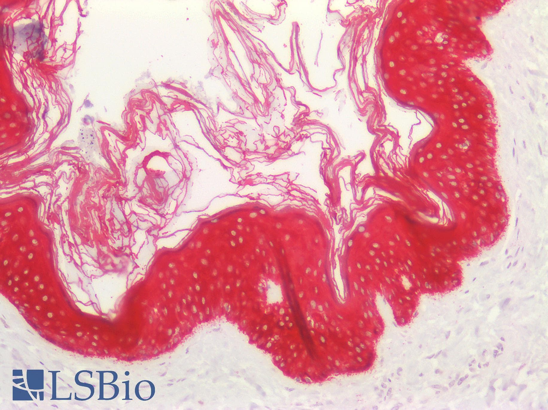 PathPlus™ Monoclonal Mouse anti-Human Basic Cytokeratin AE3 Antibody (clone AE-3, Concentrated, IHC, WB)