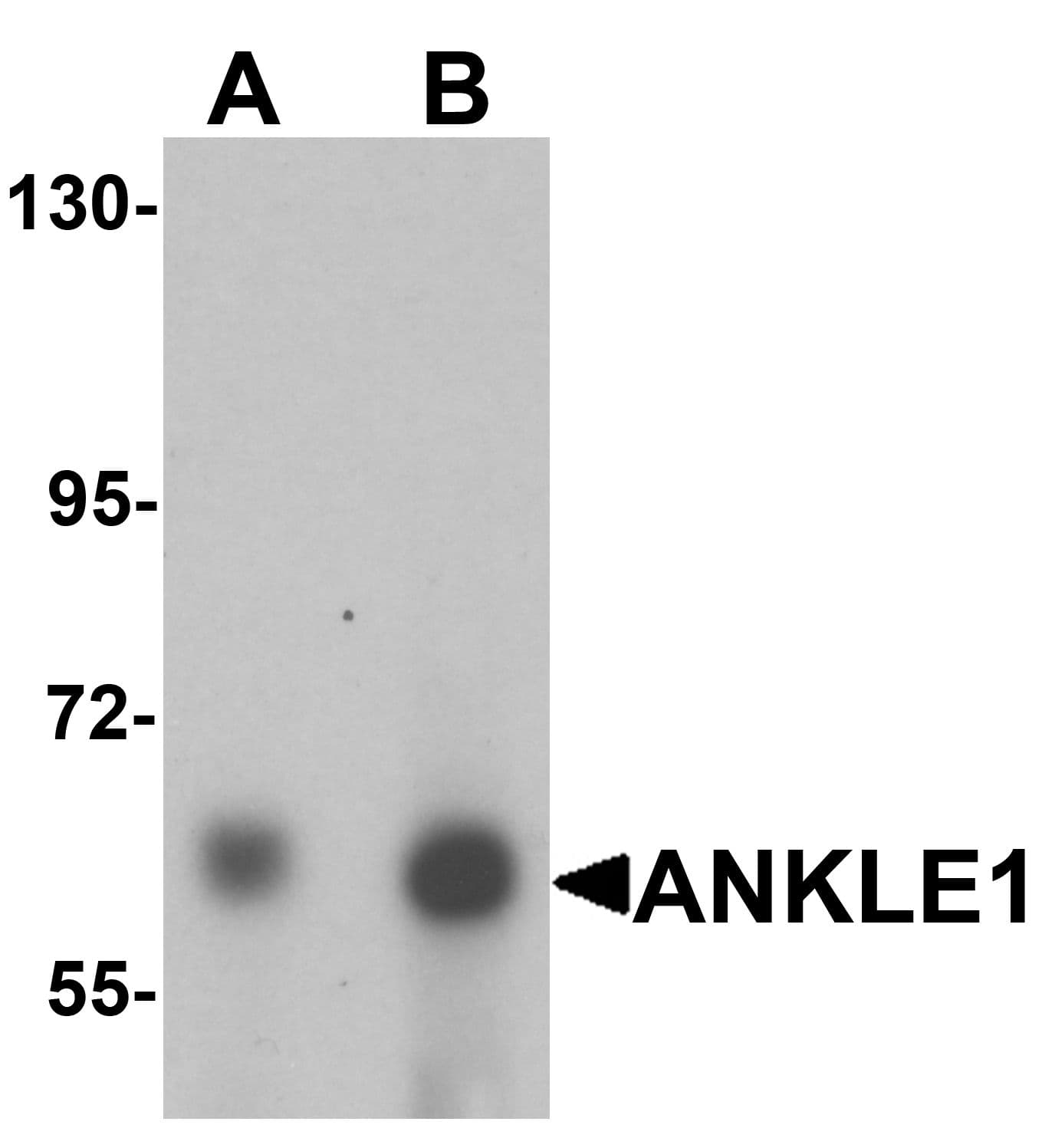 IHC-plus™ ANKLE1 Antibody