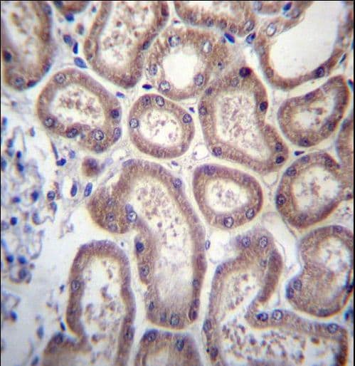 Polyclonal Rabbit anti-Human SP140 Antibody (aa272-301, IHC, IF, WB)