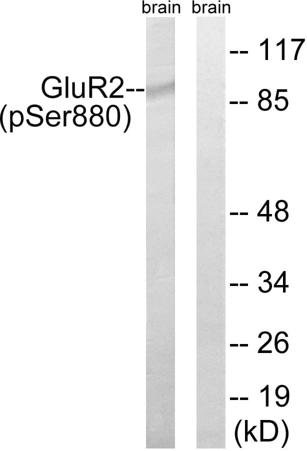GRIA2 / GLUR2 Antibody (phospho-Ser880)