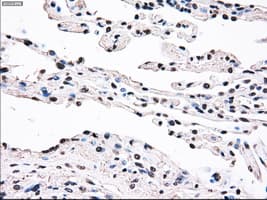 Monoclonal Mouse anti-Human SSB / La Antibody (clone OTI3F11, IHC, IF, WB)