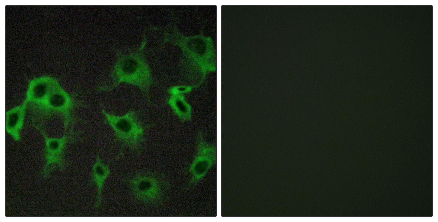ADRB2 Antibody