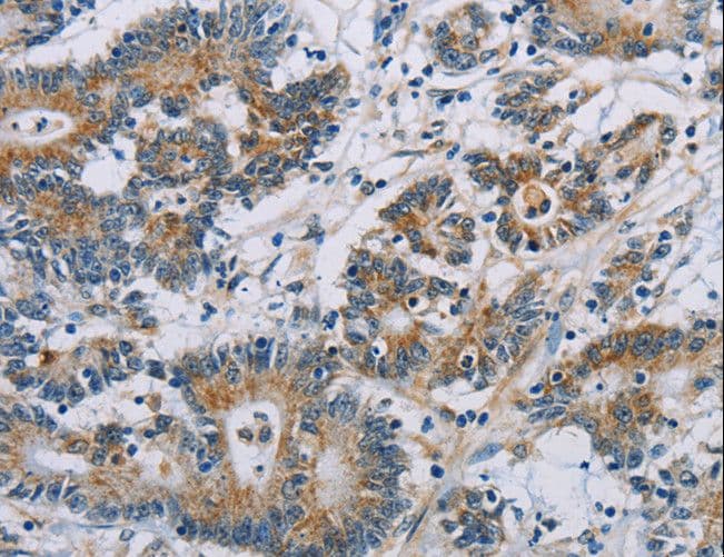 Polyclonal Rabbit anti-Human CSNK1E / CK1 Epsilon Antibody (IHC, WB)