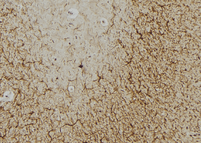 NES / Nestin Antibody