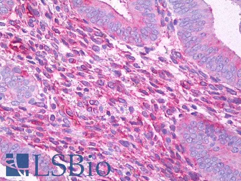 IHC-plus™ Fragilis / IFITM3 Antibody (Internal, clone EPR5242)