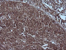 MAP2K1 / MKK1 / MEK1 Antibody (clone OTI4H8, Carrier-free)