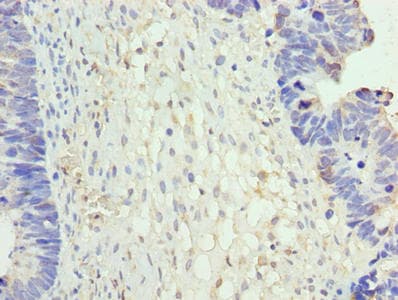 Polyclonal Rabbit anti-Human NR2C2AP / TRA16 Antibody (IHC, WB)