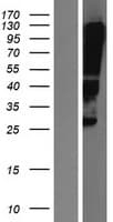 CLDN12 / Claudin 12 Protein (Over-Expression Lysate Myc-DDK (Flag))