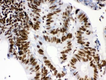 RBBP4 / RBAP48 Antibody